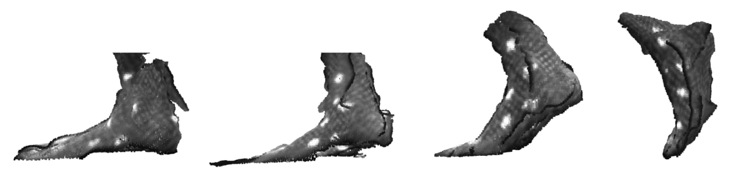 Profile view of foot morphology