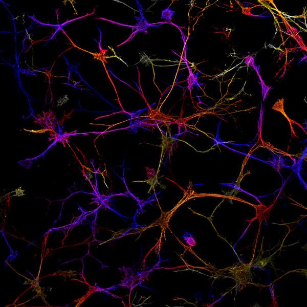 Bone cells spread and form connections in an engineered hydrogel. 2024, M Ohnsorg, 2nd Place.
