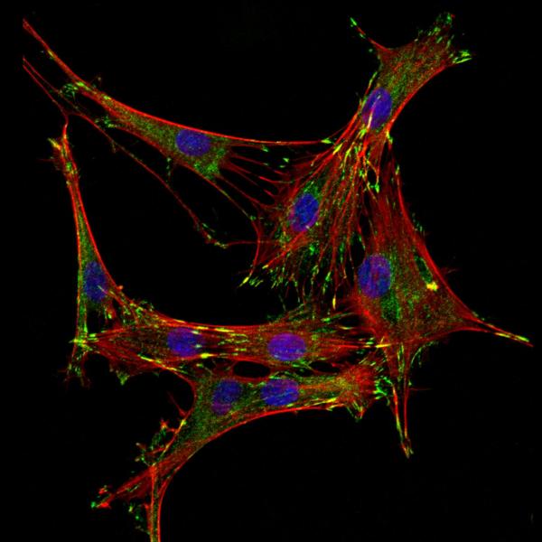 Matrix stiffness affects focal adhesions (green) and cytoskeletal architecture (red). 2016, A Killaars, 3rd Place.