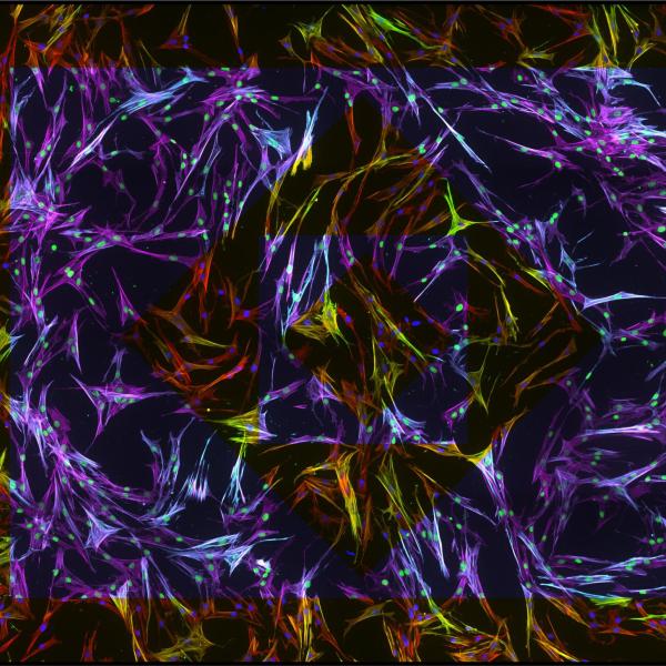 Stress fiber-abundant cells grown on a stiff matrix. 2016, M Schroeder & A Rodriguez Gonzalez, 2nd Place.