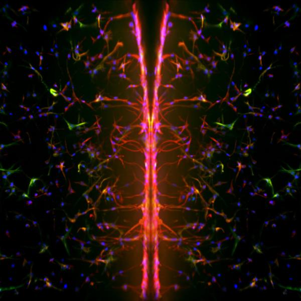 Cellular processes extend to interact with a 3D matrix. 2018, M Schroeder, Honorable Mention.