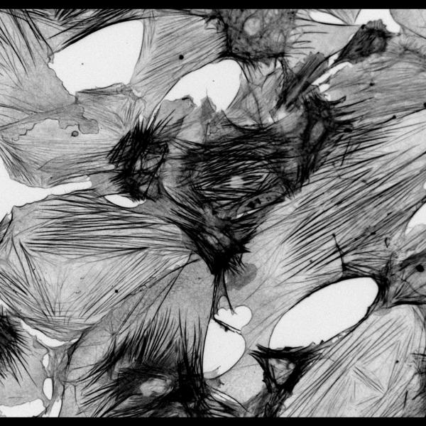 Cardiac fibroblasts cultured on stiff hydrogels show aSMA stress fibers. 2019, T Ceccato, 3rd Place.