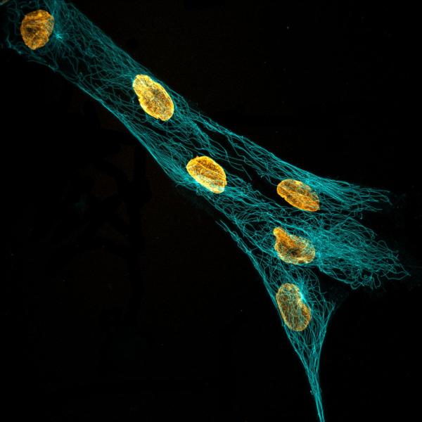 hMSC tubulin & nuclei visualized with increased clarity via expansion microscopy. 2019, V Rao, 2nd Place.