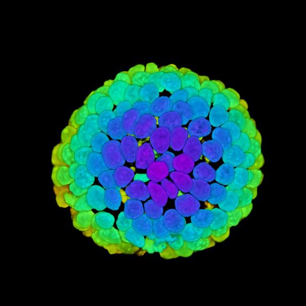 Tightly packed intestinal organoid nuclei are shown with color representing z-depth. 2019, M Yavitt, 1st Place.