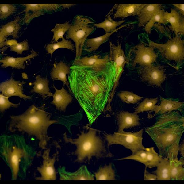 Sex-specific cardiac fibrosis-promoting cells (green) influence disease phenotypes. 2020, B Aguado, 3rd Place.