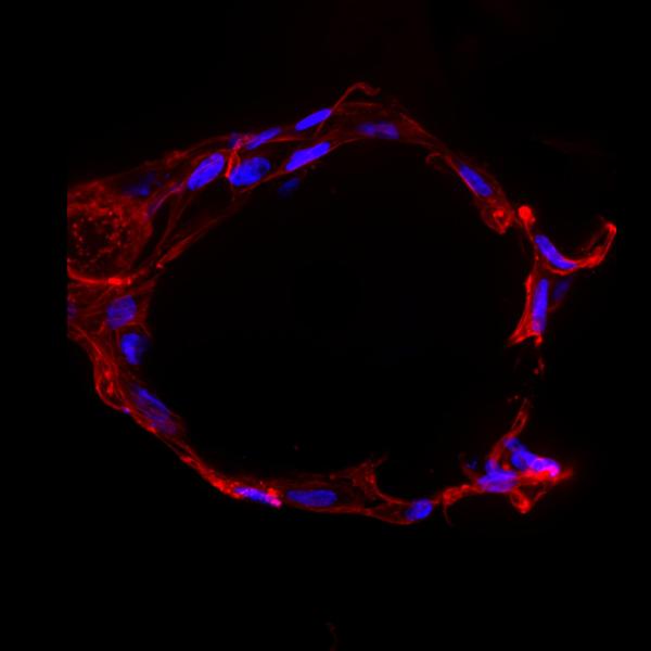 200 micron spherical microgel scaffold supporting 3D cell culture. 2020, V Rao, Honorable Mention.