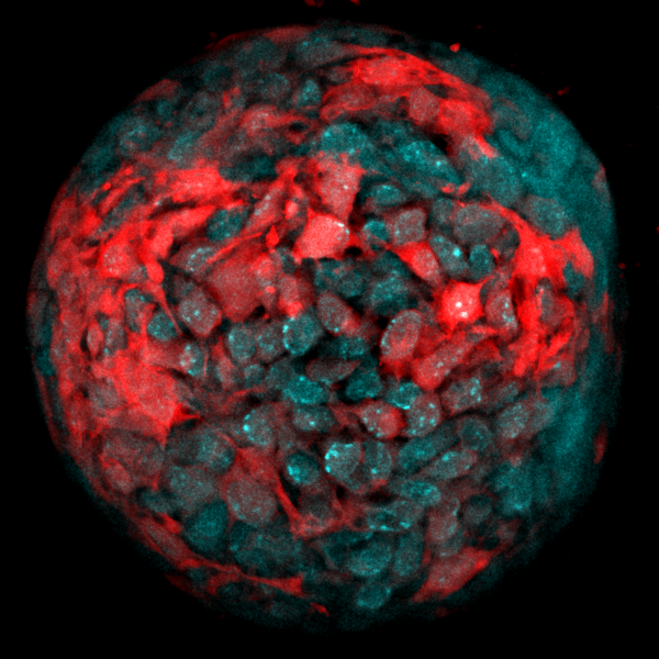 Human intestinal stem cells self-assemble into multicellular organoids. 2021, M Blatchley, 4th Place.