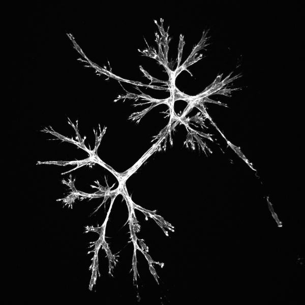 MSCs in a stress-relaxing network organize into fractal-like patterns. 2021, A Borelli, 2nd Place.