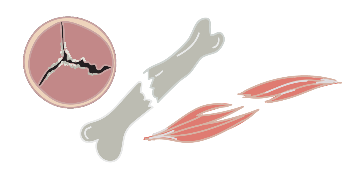 MSCs, muscle cells, aortic valve fibroblasts