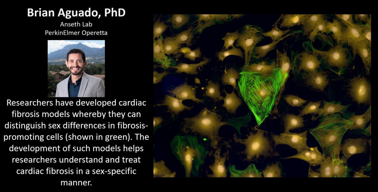Brian Aguado took 3rd place in the 2020 Biofrontiers Up-Close Image Competition.