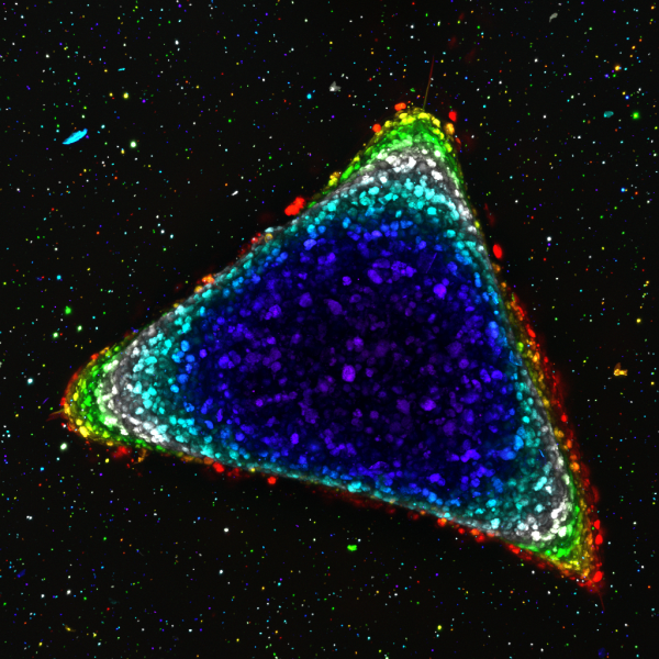 A depth-coded image of a geometrically defined 3D cancer cell aggregate. 2022, B Kirkpatrick & D Shin, Honorable Mention.