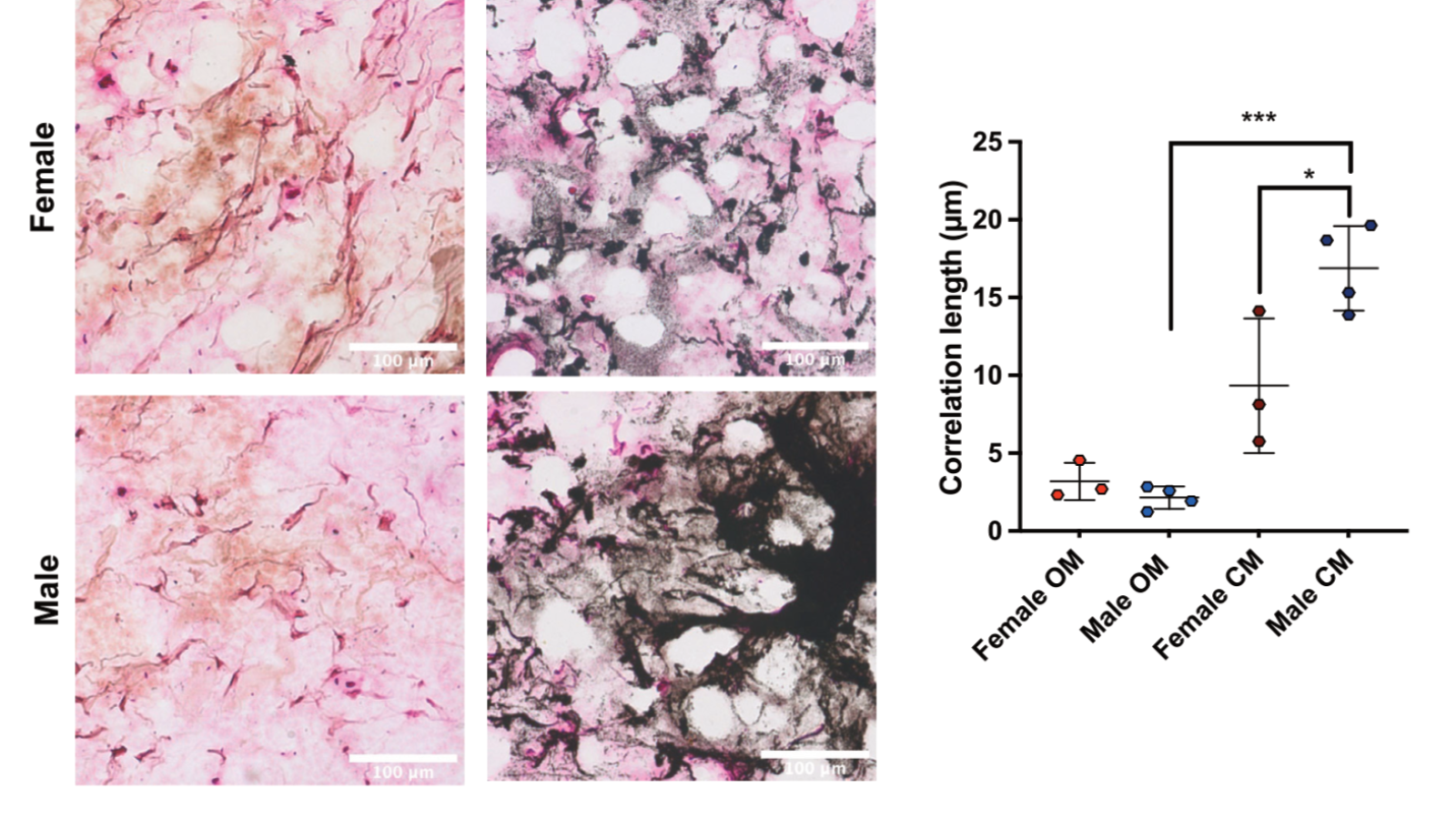 PEG + Col hydrogels in calcifying medium show reduced calcification in female samples
