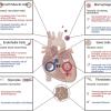 Matters of the heart