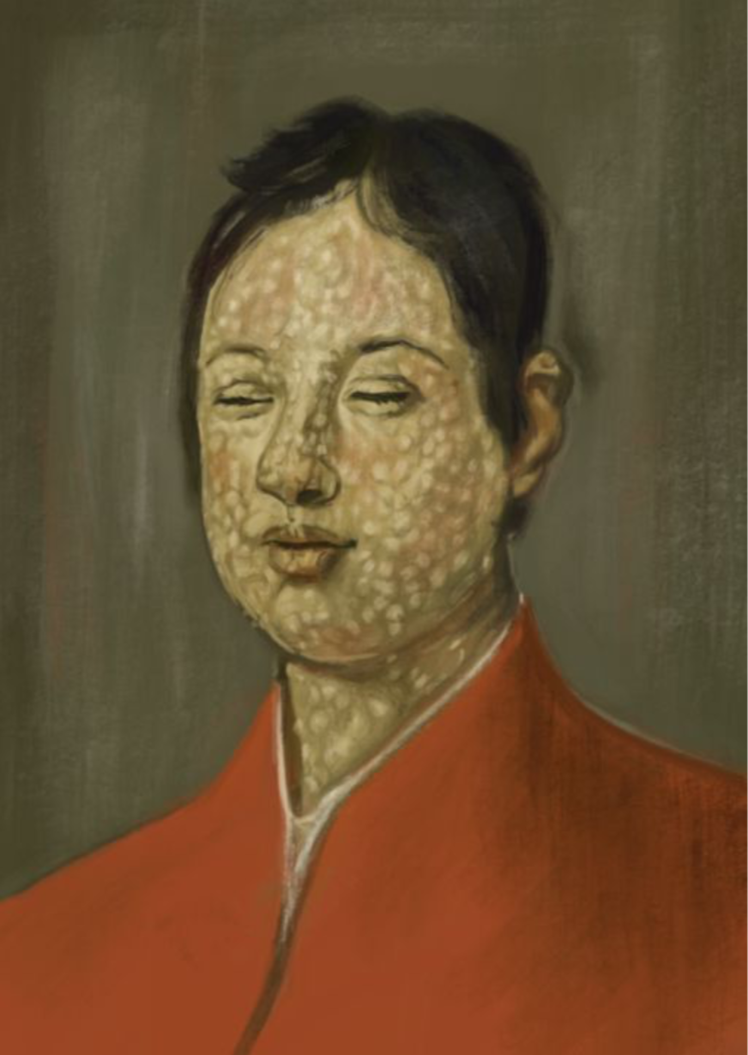 Oil painting of Ferdinando II de Medici on the ninth day of his smallpox infection in 1626