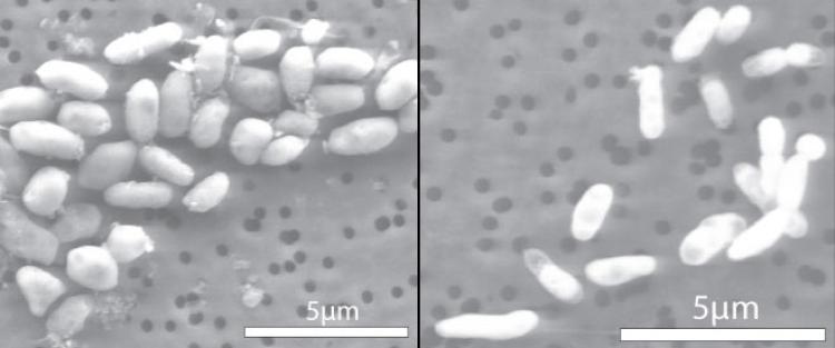 A microscopic comparison shows shows bacteria grown in an arsenic-rich medium (left) vs. a phosphorous-rich medium (right). Photo by Jodi Switzer Blum