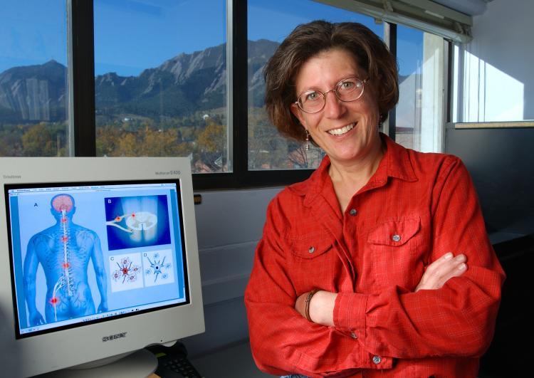 Linda Watkins, CU-Boulder distinguished professor of psychology and neuroscience, has patented a treatment that holds promise for those who suffer from chronic pain.