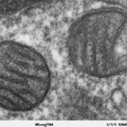 Two mitochondria from mammalian lung tissue displaying their matrix and membranes as shown by electron microscopy. Photo: Louisa Thomas / Wikipedia