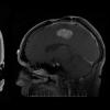 MRI of the Brain