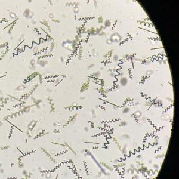 bioreactor petri dish