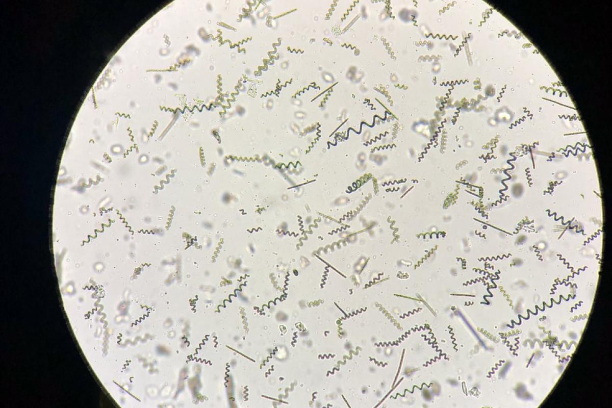 Bioreactor