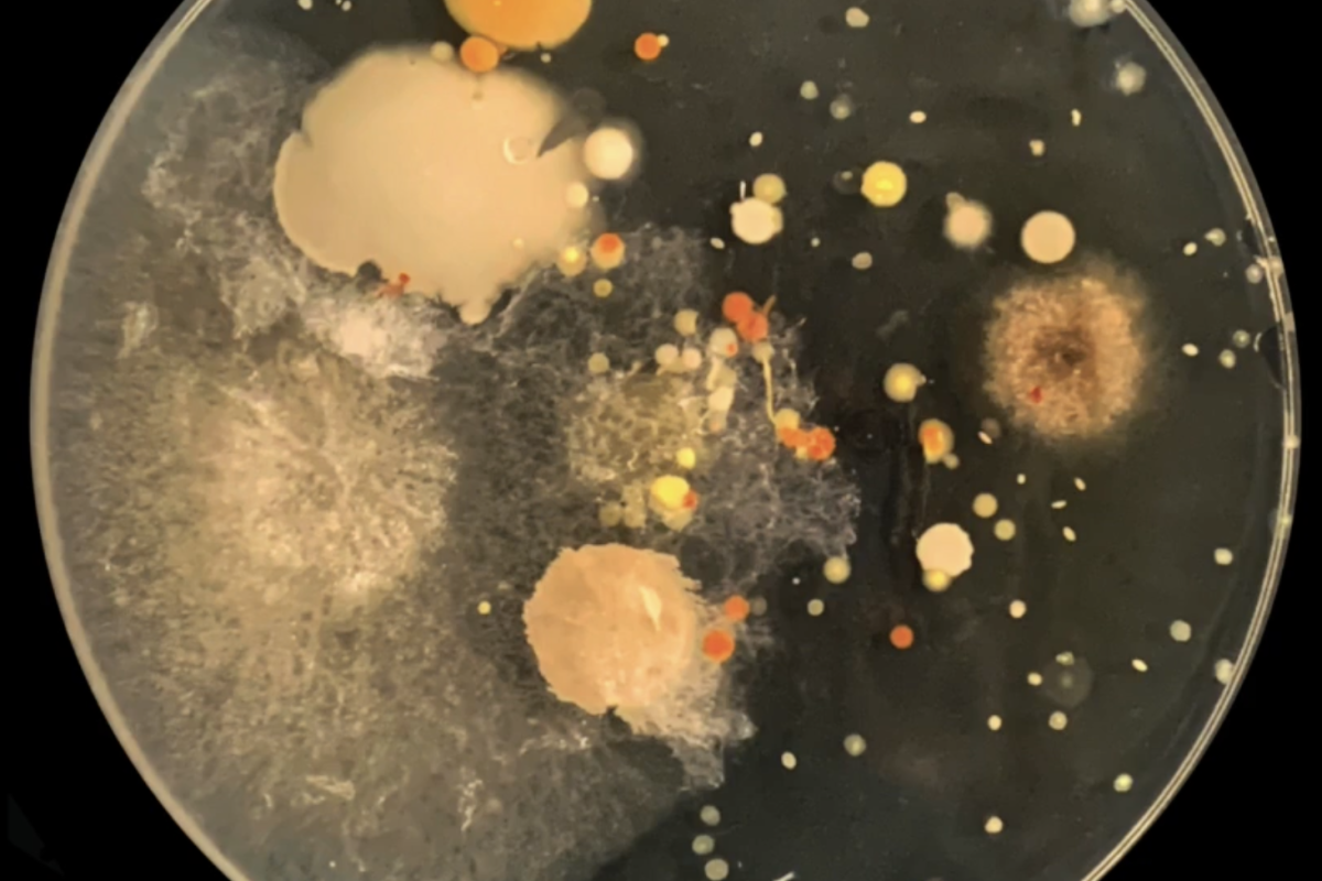 Bacteria culture