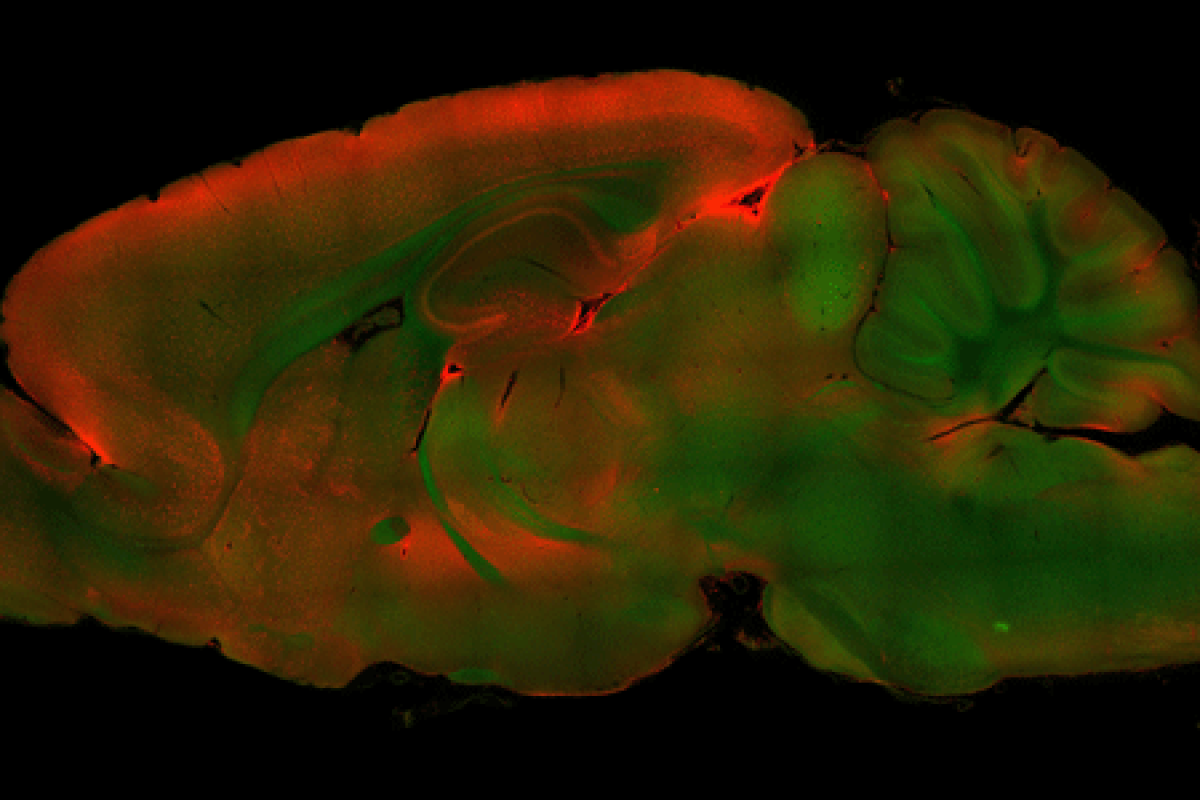 stained brain image