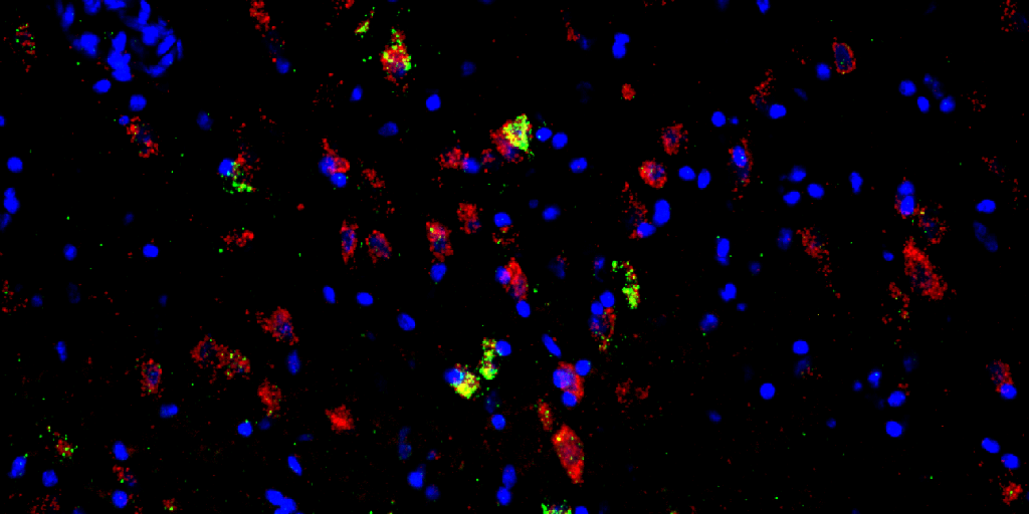 Fluorescence in situ hybridization