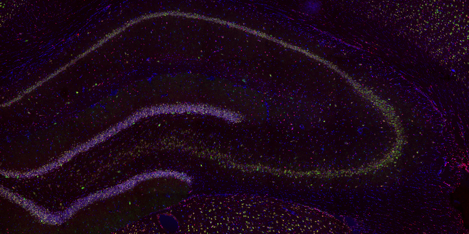 Hippocampus image