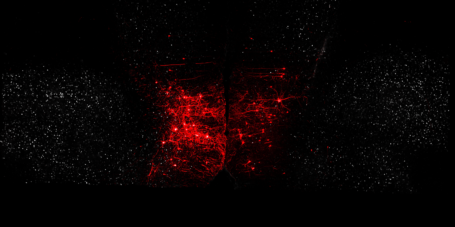 PFC image