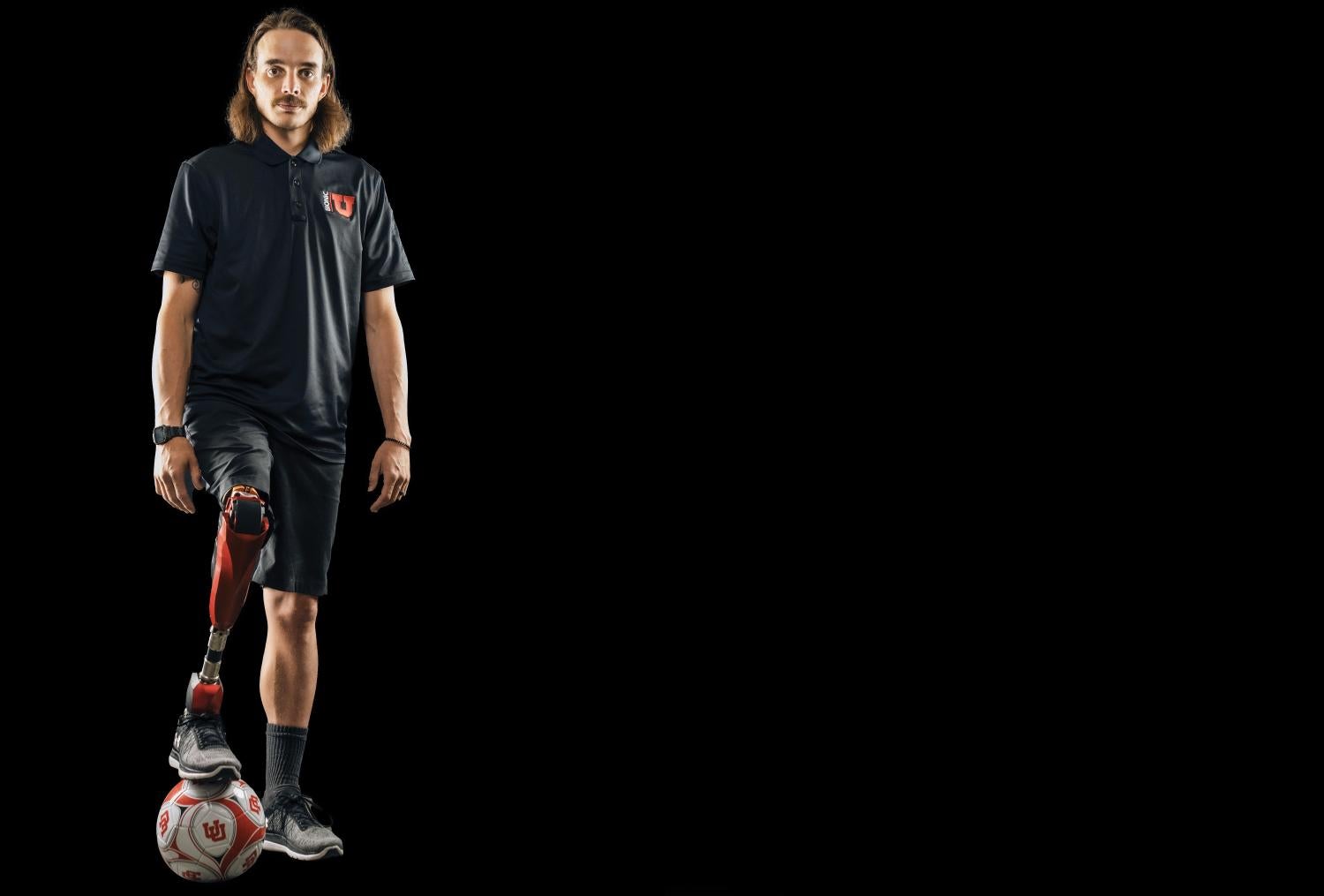 A man with a bionic leg replacement