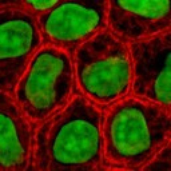 cell culture