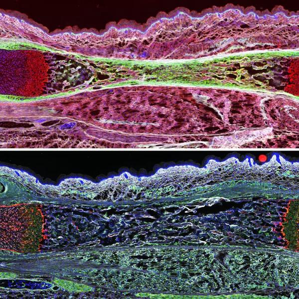 Colorful microscopic image of bone cross-section