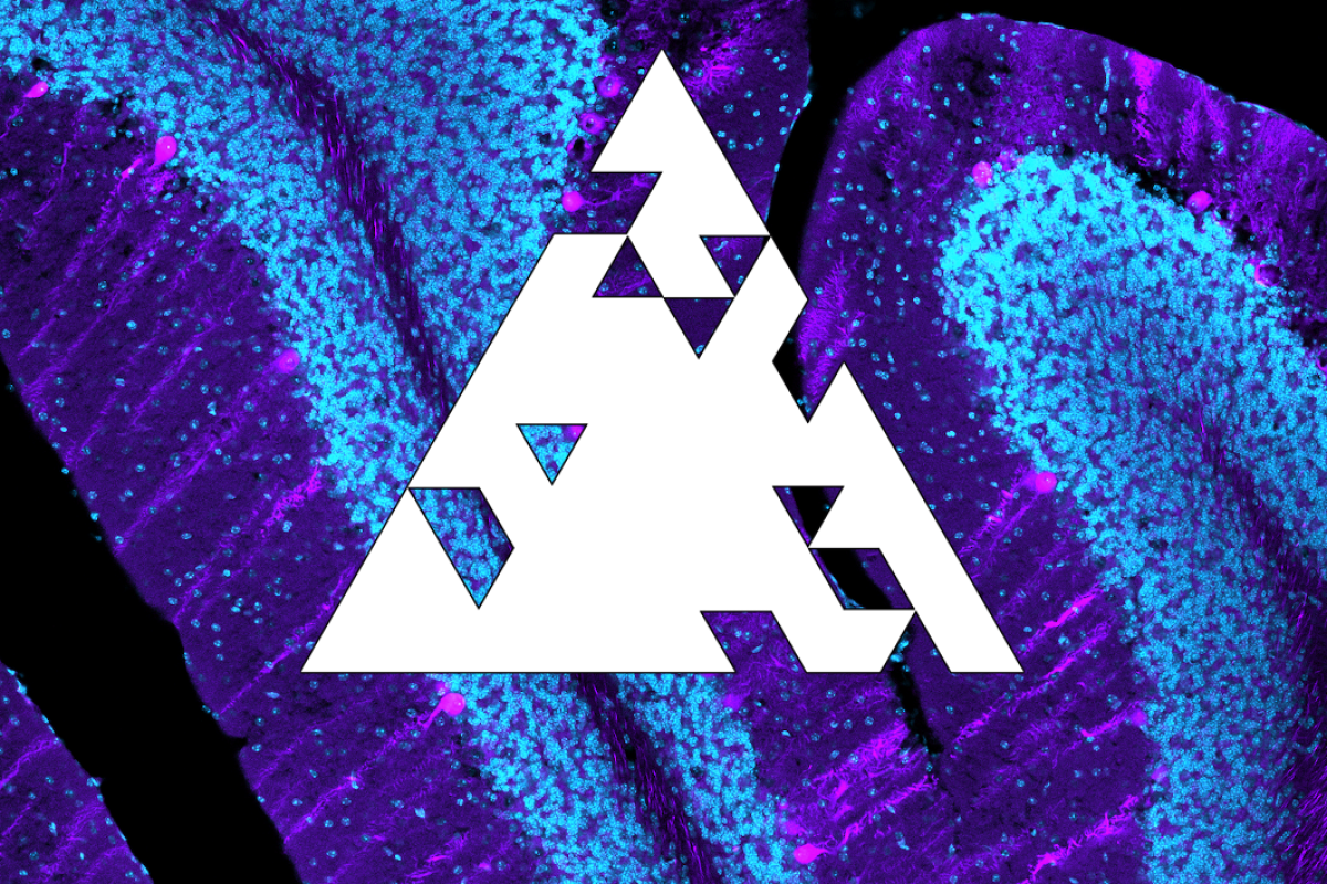 Brain micrograph with a disintegrating triangle icon overlayed