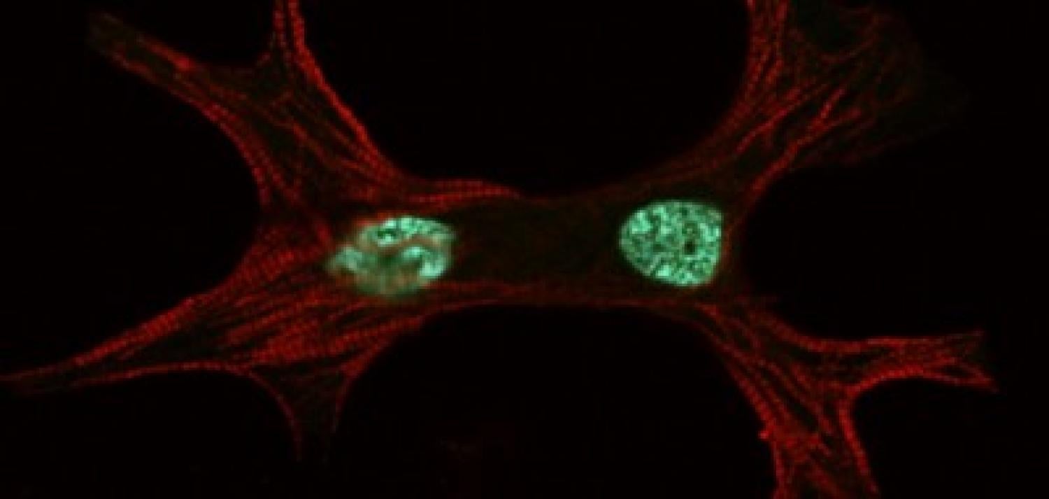 A cardiomyocyte imaged by the BioFrontiers Advanced Imaging Facility.