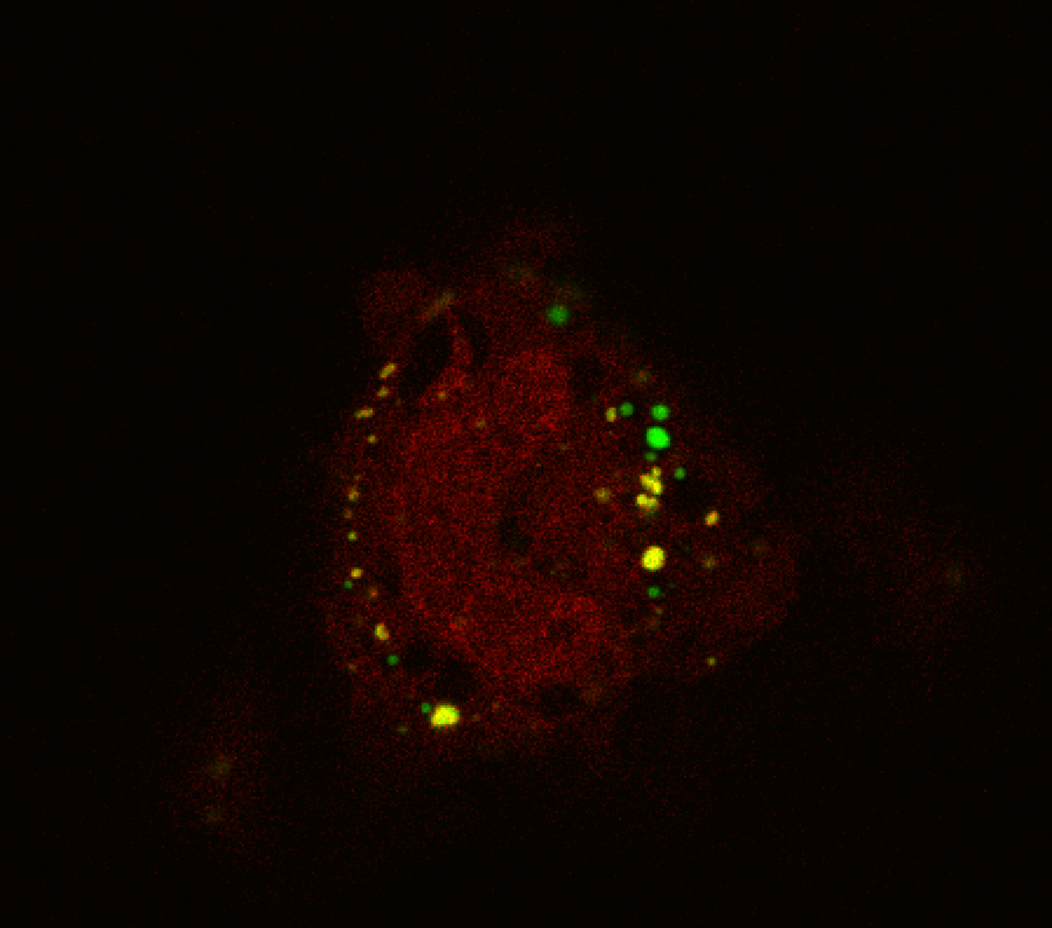 Visualization of U-bodies in live mammalian cells