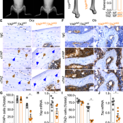 8 kb‐DMP1‐Cre selectively ablated YAP/TAZ expression from osteocytes