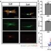 Influence of substrate modulus on YAP nuclear localization and AcK modification