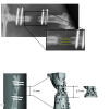 Representation of defect bridging measures.