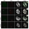 Cellular DNA damage repair proteins localize to viral replication centers.