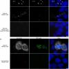 TERT exon and intron single-molecule RNA FISH (smFISH) probe design and specificity.