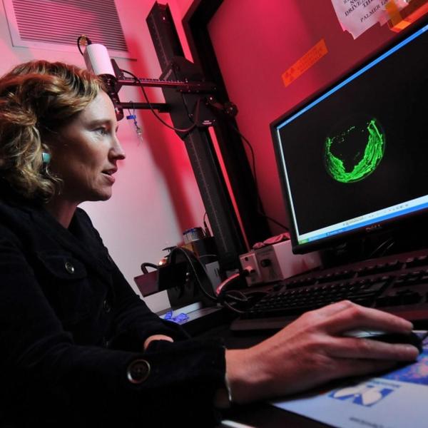 Biochemistry Professor Amy Palmer uses creative chemistry to track the movement of metals and other molecules in living cells, especially when those molecules play a role in human diseases.