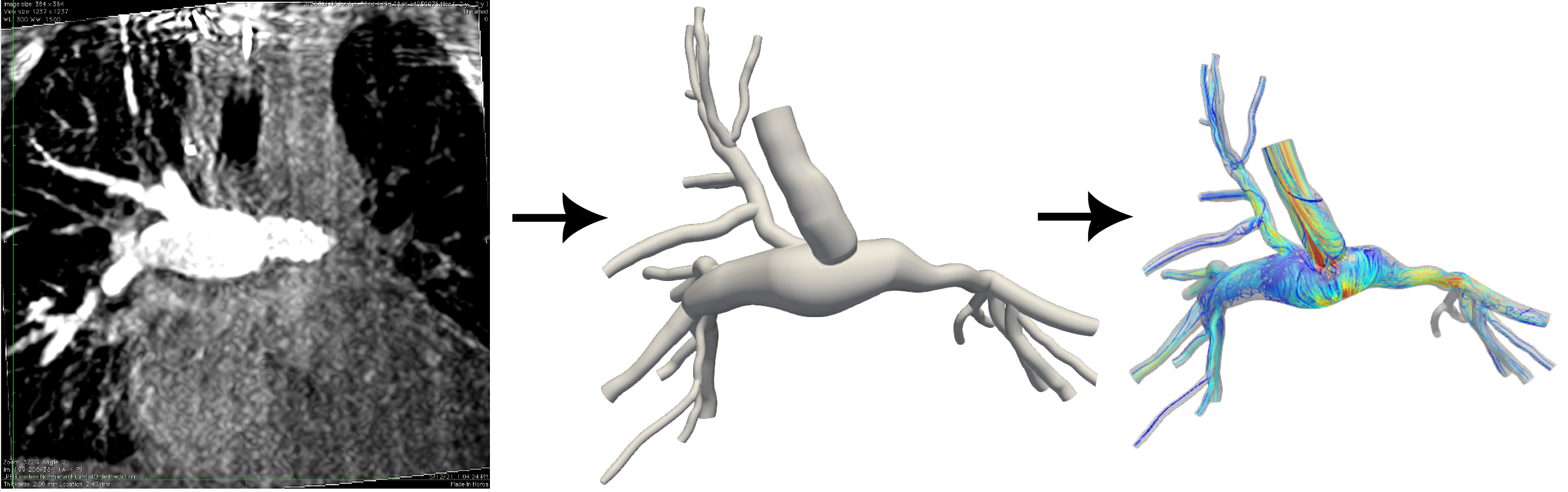 Development of model