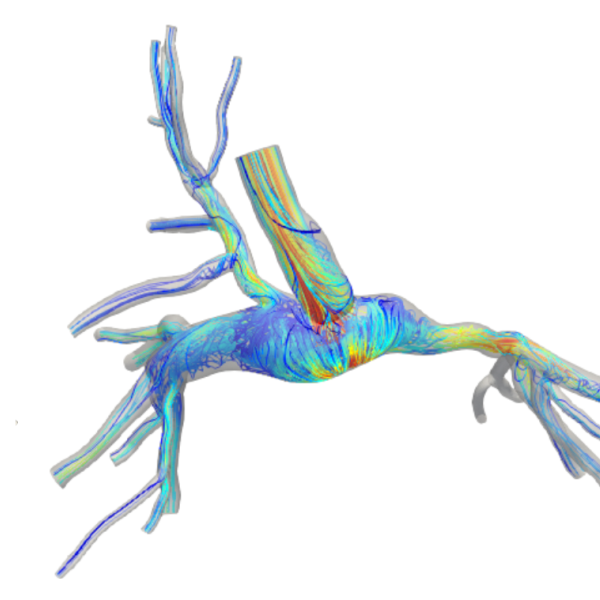 in-silico model