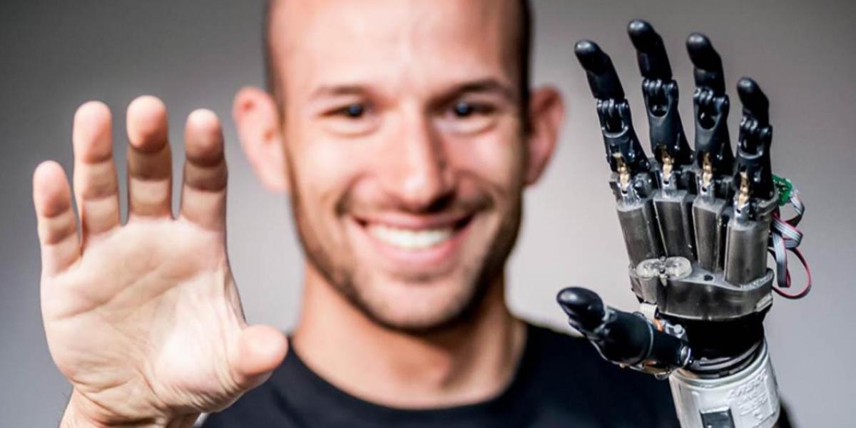Jacob segil, prosthetic device