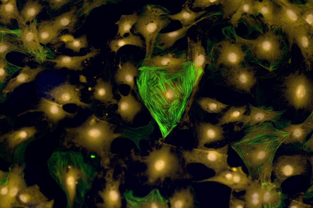 Cardiac fibroblasts, Brian Aguado, Anseth research group