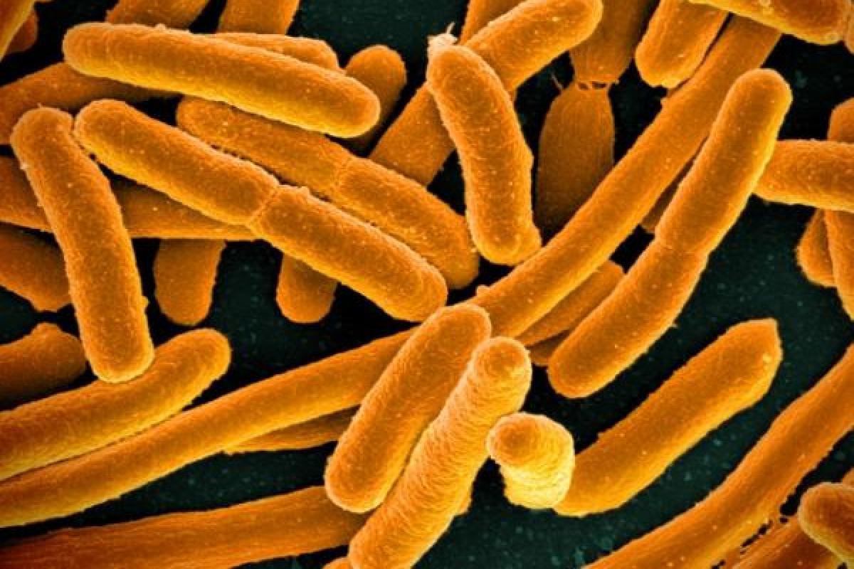 Escheria coli