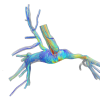 in-silico model