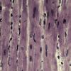 Nuclear deformation research