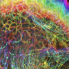interface of skin and muscle