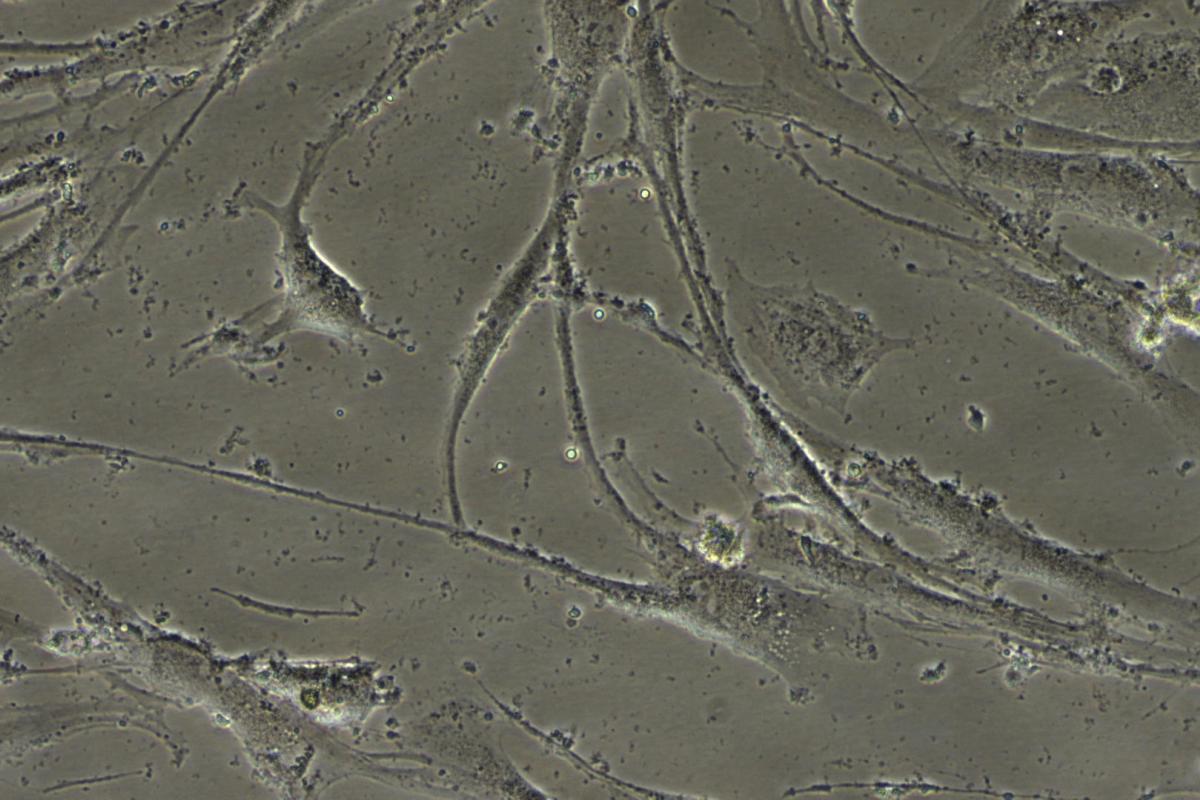 Mesenchymal Stem Cells